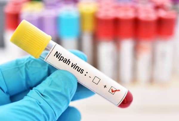 What are the Causes and Treatment For Nipah Virus Outbreak